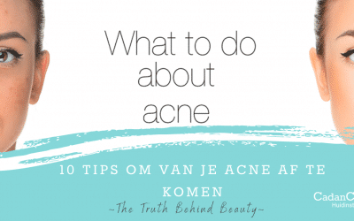 10 tips om van je acne af te komen