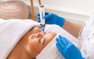Dermapen en acne littekens