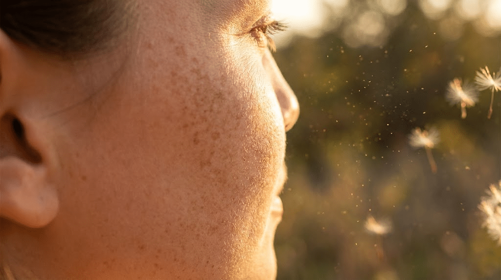 pigmentvlekken door zonlicht